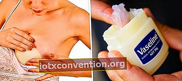 Seorang wanita yang mempunyai kulit tegap di payudaranya berkat petroleum jelly