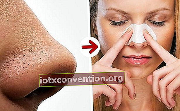 Mitesser in der Nase können mit Mehl und Honig entfernt werden