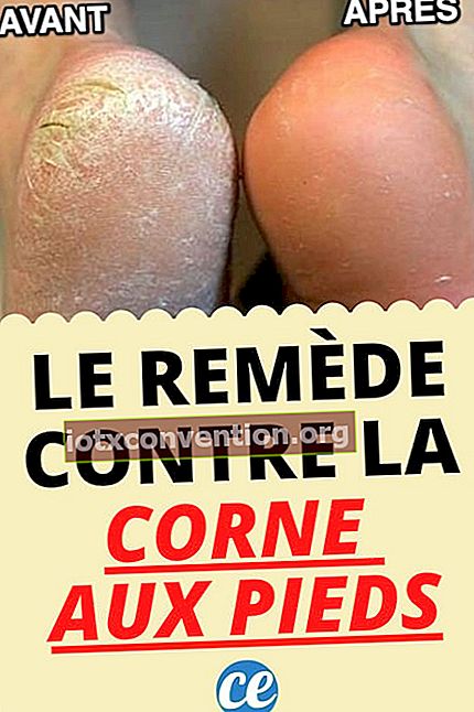 Corne aux Pieds: สูตรของคุณยายที่เดินตามไฟของพระเจ้า!