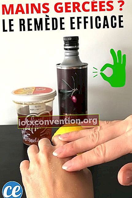 Eine Flasche Olivenöl, Honig, eine Zitrone und sanfte Hände im Vordergrund