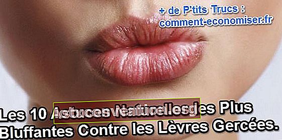 natürliche Tipps für rissige Lippen