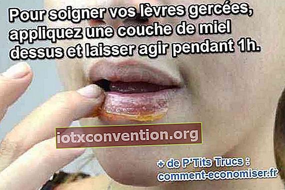 natürliche Pflege zur Behandlung rissiger Lippen