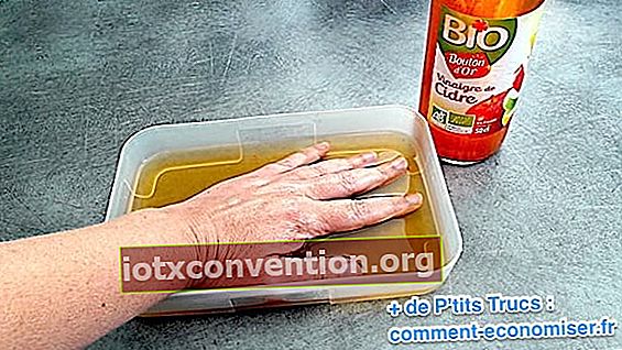 immergere le mani nell'aceto di sidro di mele caldo per alleviare l'eczema