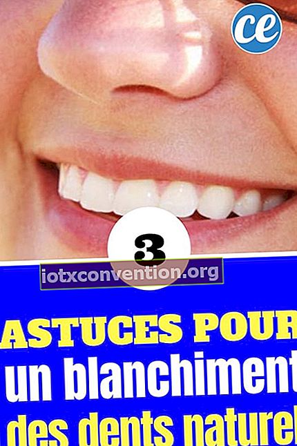 3 consigli per i denti bianchi