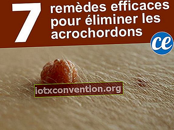 7 ubat buatan sendiri dan mesra bajet untuk menyembuhkan tanda kulit